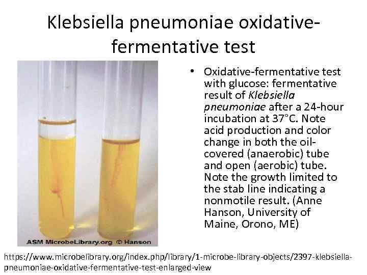 Klebsiella pneumoniae oxidativefermentative test • Oxidative-fermentative test with glucose: fermentative result of Klebsiella pneumoniae