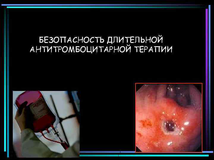 БЕЗОПАСНОСТЬ ДЛИТЕЛЬНОЙ АНТИТРОМБОЦИТАРНОЙ ТЕРАПИИ 