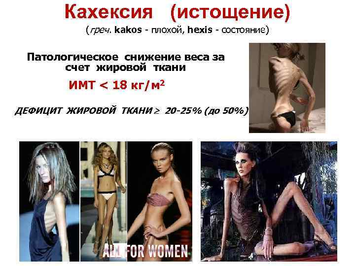 Кахексия (истощение) (греч. kakos - плохой, hexis - состояние) Патологическое снижение веса за счет