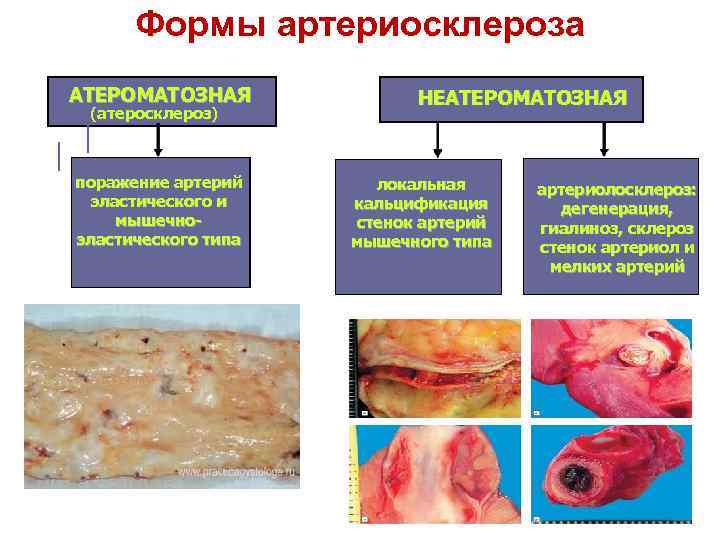 Патология белой крови патофизиология презентация