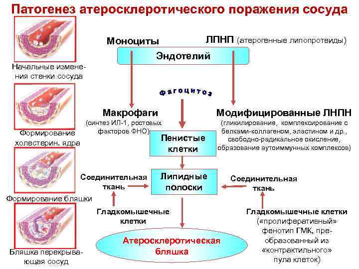 Схема развития атеросклероза