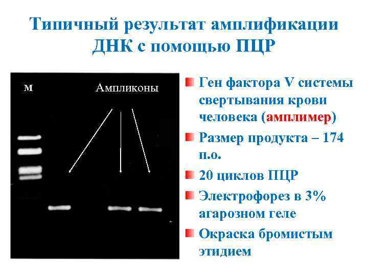 Типичный результат амплификации ДНК с помощью ПЦР M Ампликоны Ген фактора V системы свертывания