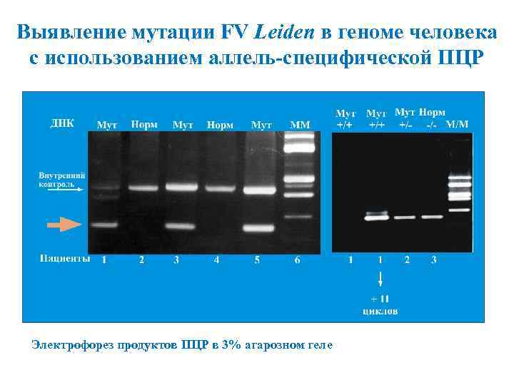 Выявление мутации FV Leiden в геноме человека с использованием аллель-специфической ПЦР Электрофорез продуктов ПЦР