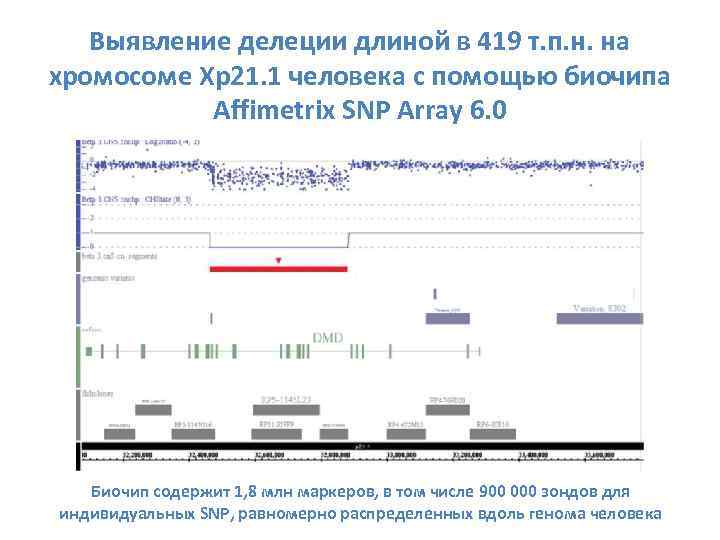 Выявление делеции длиной в 419 т. п. н. на хромосоме Xp 21. 1 человека