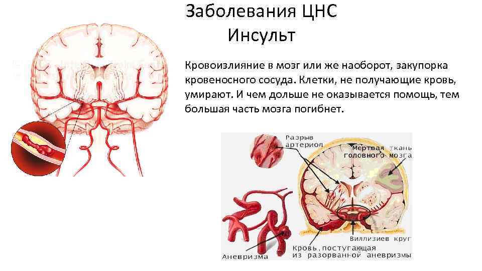 Заболевания нервной системы картинки