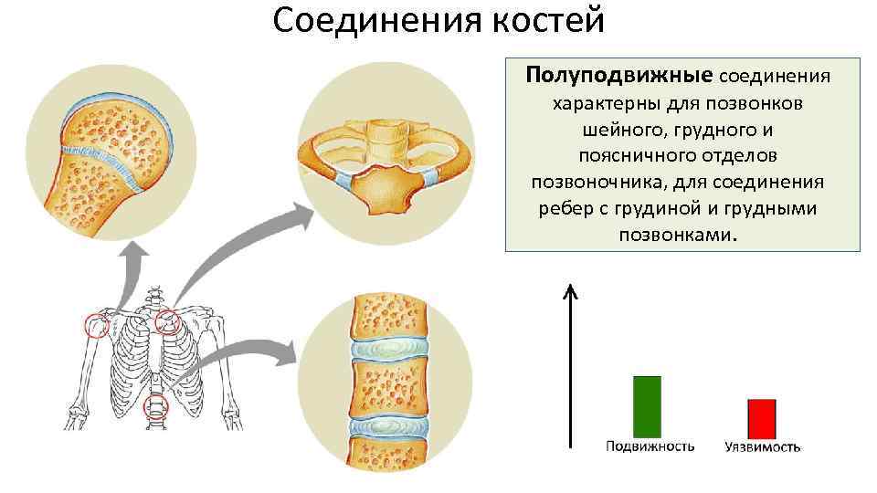 Соединения костей Полуподвижные соединения характерны для позвонков шейного, грудного и поясничного отделов позвоночника, для