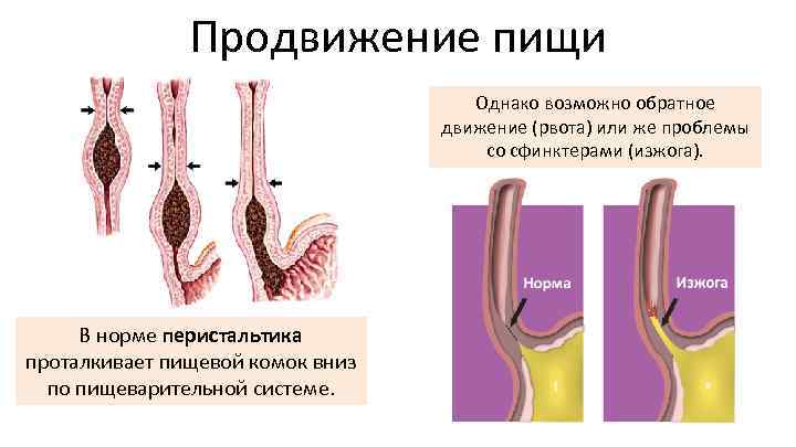 Продвижение пищи Однако возможно обратное движение (рвота) или же проблемы со сфинктерами (изжога). В
