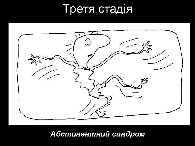 Третя стадія Абстинентний синдром 