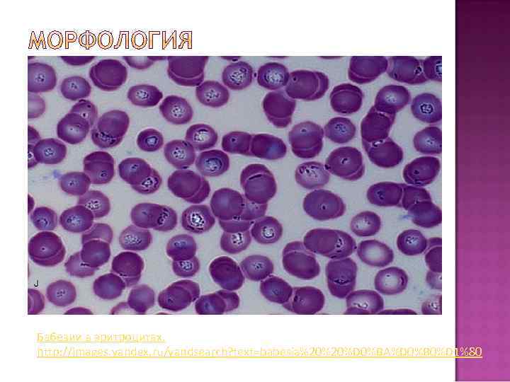 Бабезии в эритроцитах. http: //images. yandex. ru/yandsearch? text=babesia%20%20%D 0%BA%D 0%B 0%D 1%80 