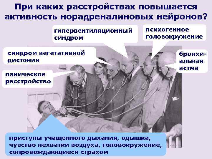 При каких расстройствах повышается активность норадреналиновых нейронов? гипервентиляционный синдром психогенное головокружение синдром вегетативной дистонии