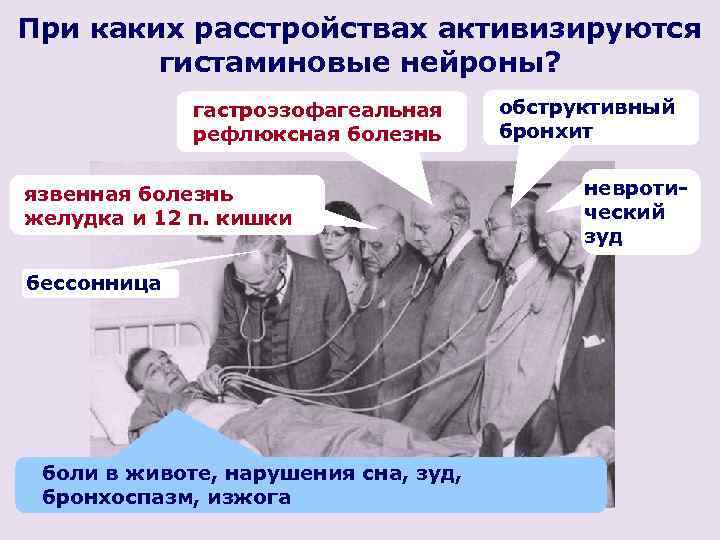 При каких расстройствах активизируются гистаминовые нейроны? гастроэзофагеальная рефлюксная болезнь язвенная болезнь желудка и 12