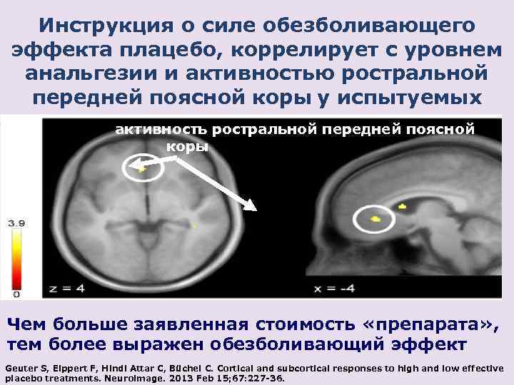 Инструкция о силе обезболивающего эффекта плацебо, коррелирует с уровнем анальгезии и активностью ростральной передней