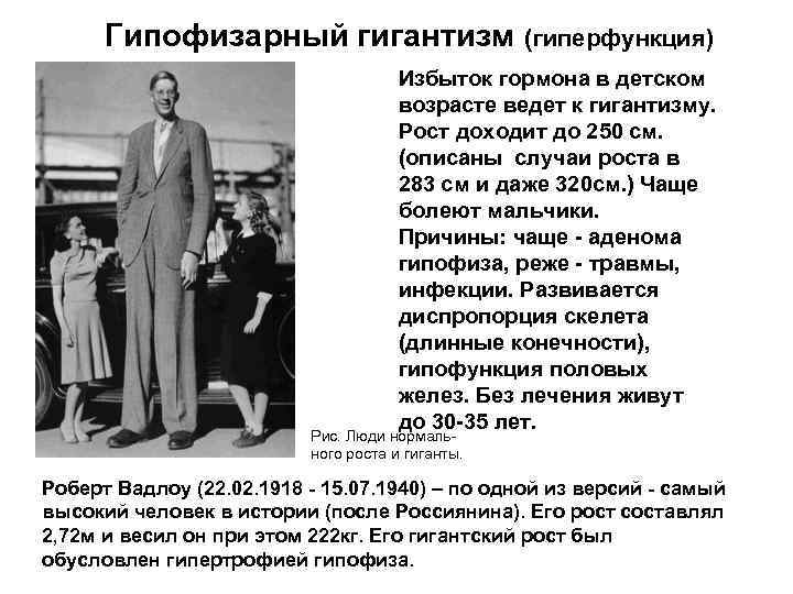 Гипофизарный гигантизм (гиперфункция) Избыток гормона в детском возрасте ведет к гигантизму. Рост доходит до