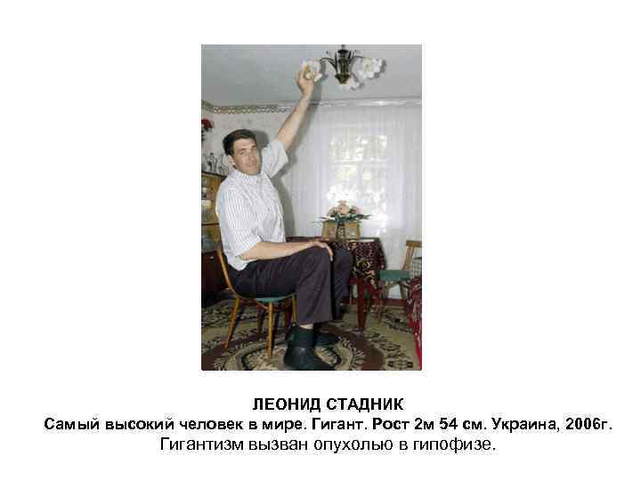 ЛЕОНИД СТАДНИК Самый высокий человек в мире. Гигант. Рост 2 м 54 см. Украина,