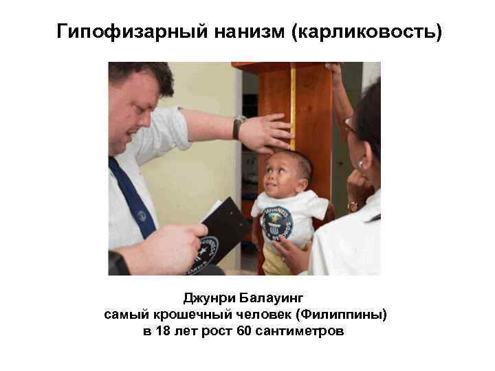 Гипофизарный нанизм (карликовость) Джунри Балауинг самый крошечный человек (Филиппины) в 18 лет рост 60