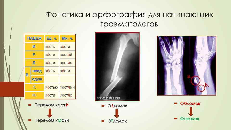 Фонетика и орфография для начинающих травматологов Перелом кост. И ОБломок Перелом к. Ости ОТломок