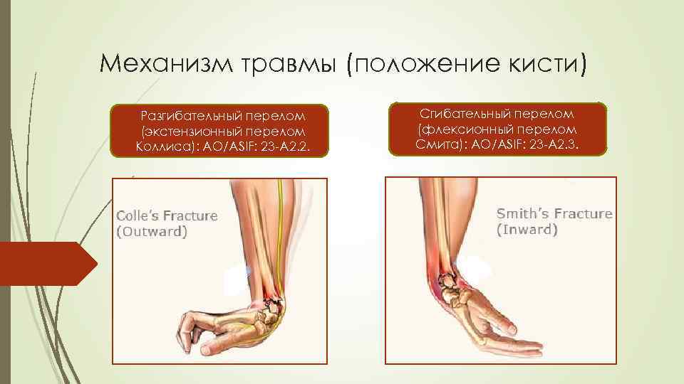 Перелом кисти карта вызова