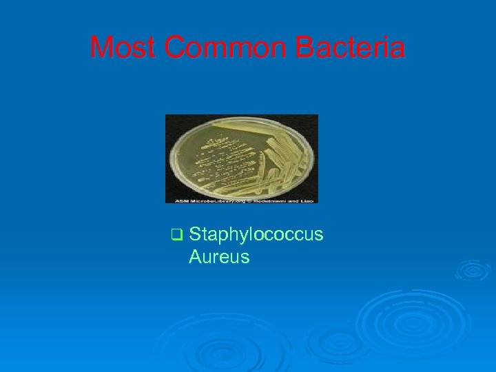 Most Common Bacteria q Staphylococcus Aureus 