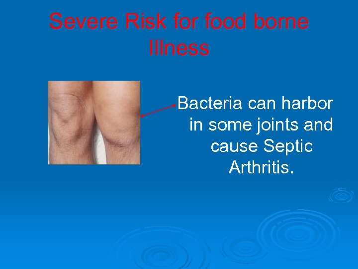 Severe Risk for food borne Illness Bacteria can harbor in some joints and cause