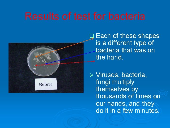 Results of test for bacteria q Each of these shapes is a different type