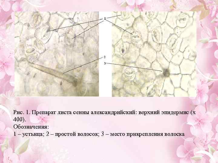  Рис. 1. Препарат листа сенны александрийский: верхний эпидермис (x 400). Обозначения: 1 –
