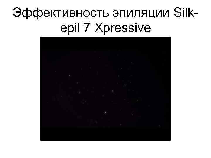 Эффективность эпиляции Silkepil 7 Xpressive 