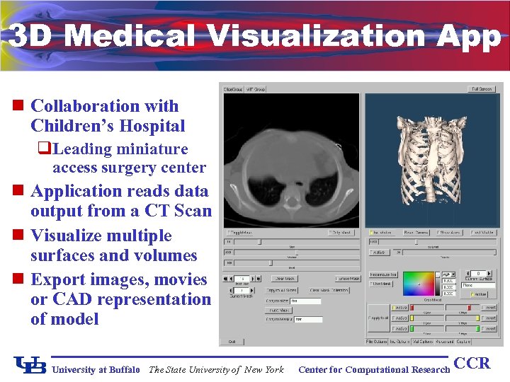 3 D Medical Visualization App n Collaboration with Children’s Hospital q. Leading miniature access