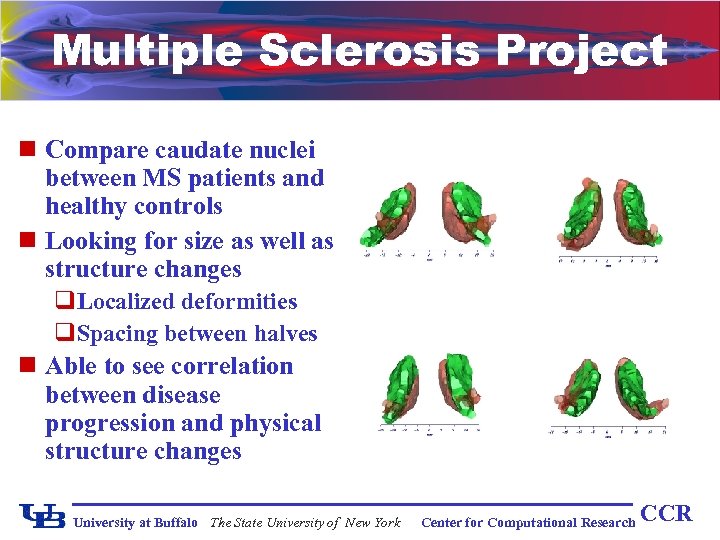 Multiple Sclerosis Project n Compare caudate nuclei between MS patients and healthy controls n