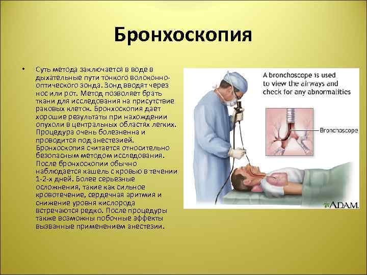 Бронхоскопия • Суть метода заключается в воде в дыхательные пути тонкого волоконнооптического зонда. Зонд