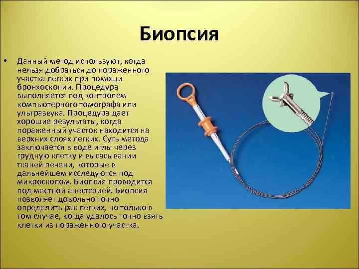 Биопсия • Данный метод используют, когда нельзя добраться до пораженного участка легких при помощи