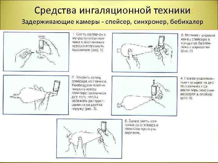  Средства ингаляционной техники: Задерживающие камеры - спейсер, синхронер, бебихалер 