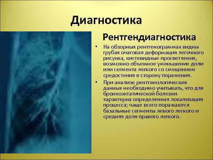 Диагностика Рентгендиагностика • На обзорных рентгенограммах видны грубая очаговая деформация легочного рисунка, кистевидные просветления,