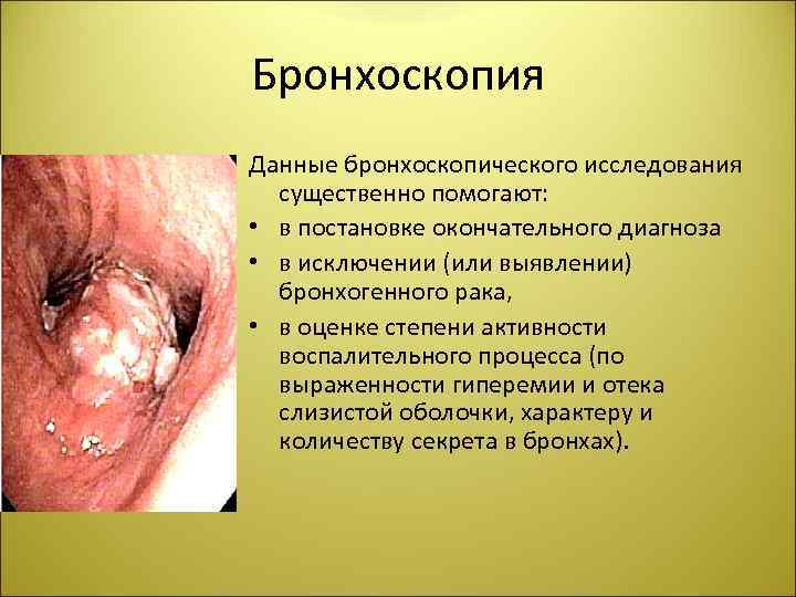 Бронхоскопия Данные бронхоскопического исследования существенно помогают: • в постановке окончательного диагноза • в исключении