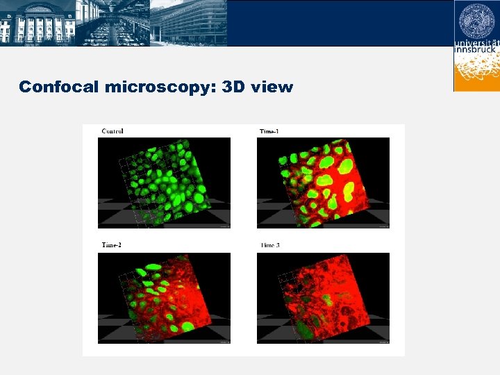 Confocal microscopy: 3 D view 