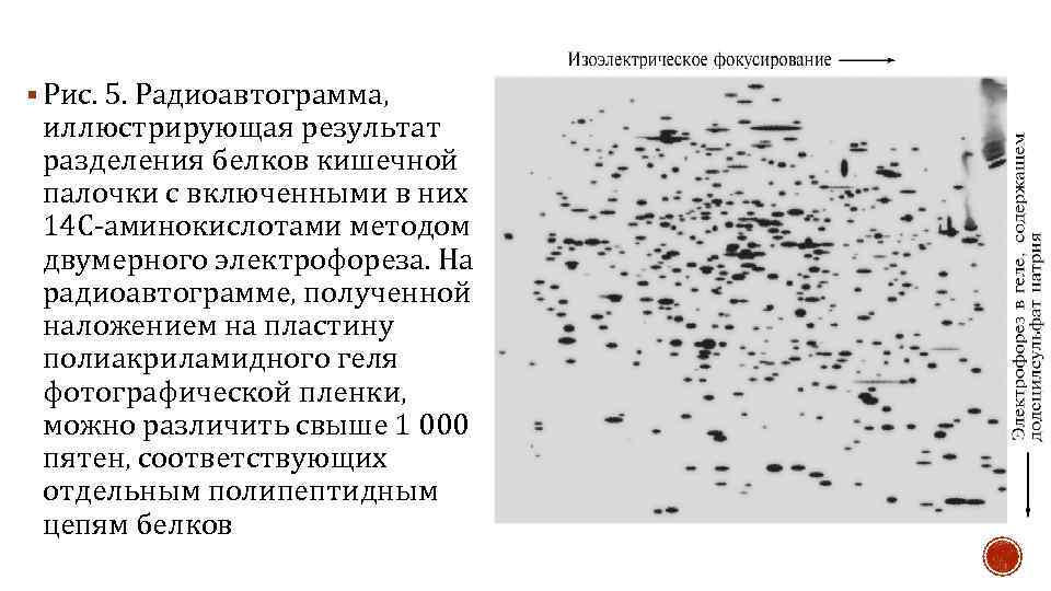 § Рис. 5. Радиоавтограмма, иллюстрирующая результат разделения белков кишечной палочки с включенными в них