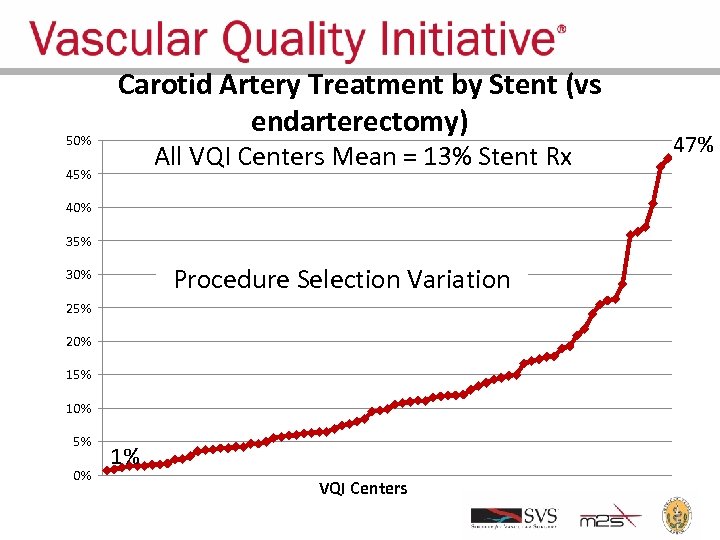 50% Carotid Artery Treatment by Stent (vs endarterectomy) All VQI Centers Mean = 13%