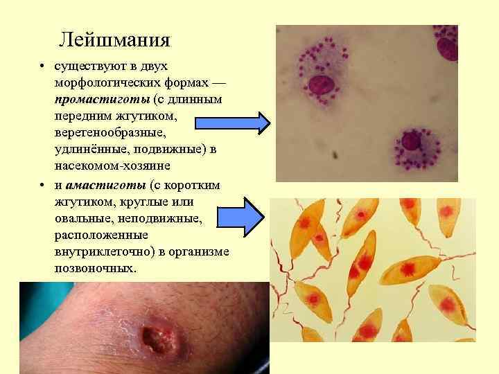 Лейшмания • существуют в двух морфологических формах — промастиготы (с длинным передним жгутиком, веретенообразные,