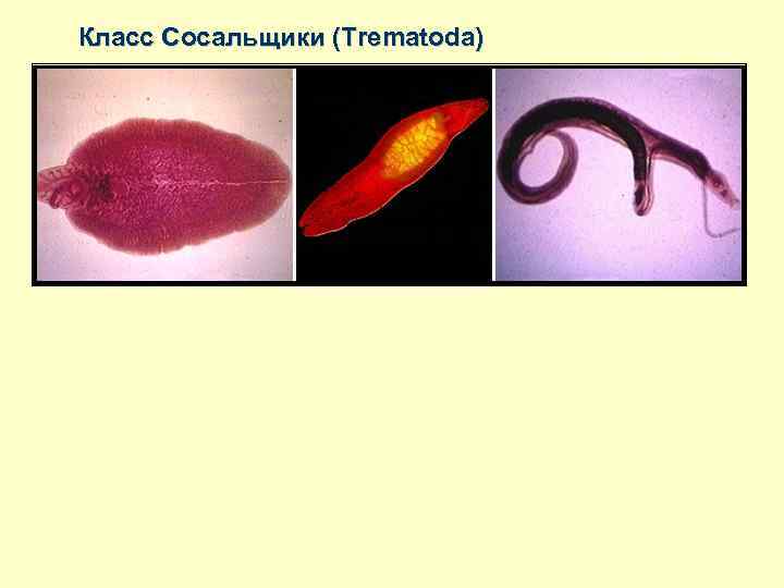 Класс Сосальщики (Trematoda) 