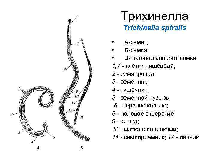 Передний и задний конец червя. Строение личинки трихинеллы. Трихинелла схема строения. Трихина строение. Трихинелла Спиралис строение личинки.
