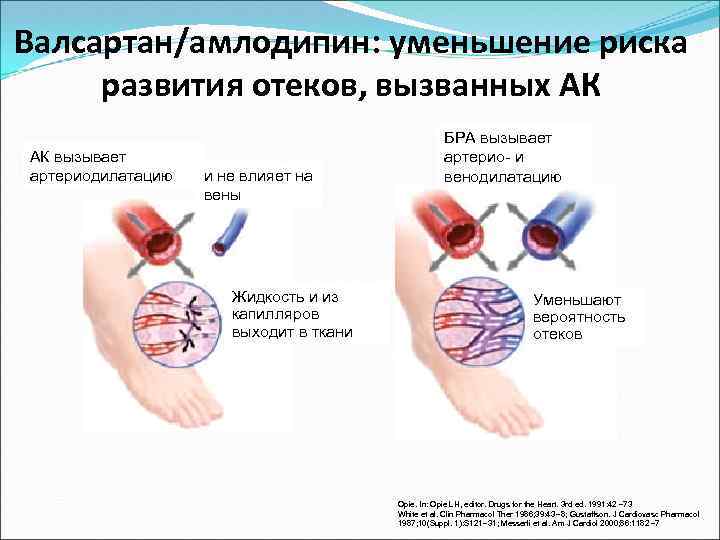 Валсартан/амлодипин: уменьшение риска развития отеков, вызванных АК АК вызывает артериодилатацию и не влияет на