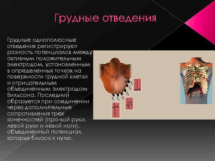 Грудные отведения Грудные однополюсные отведения регистрируют разность потенциалов между активным положительным электродом, установленным в