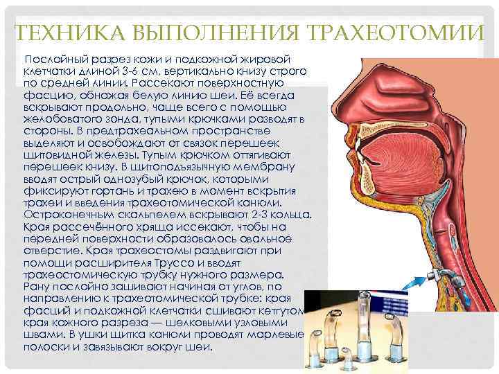 ТЕХНИКА ВЫПОЛНЕНИЯ ТРАХЕОТОМИИ Послойный разрез кожи и подкожной жировой клетчатки длиной 3 -6 см,