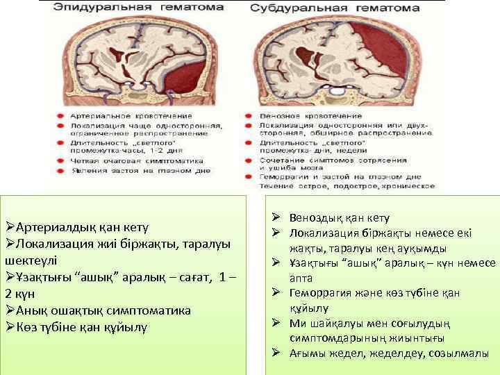 ØАртериалдық қан кету ØЛокализация жиі біржақты, таралуы шектеулі ØҰзақтығы “ашық” аралық – сағат, 1