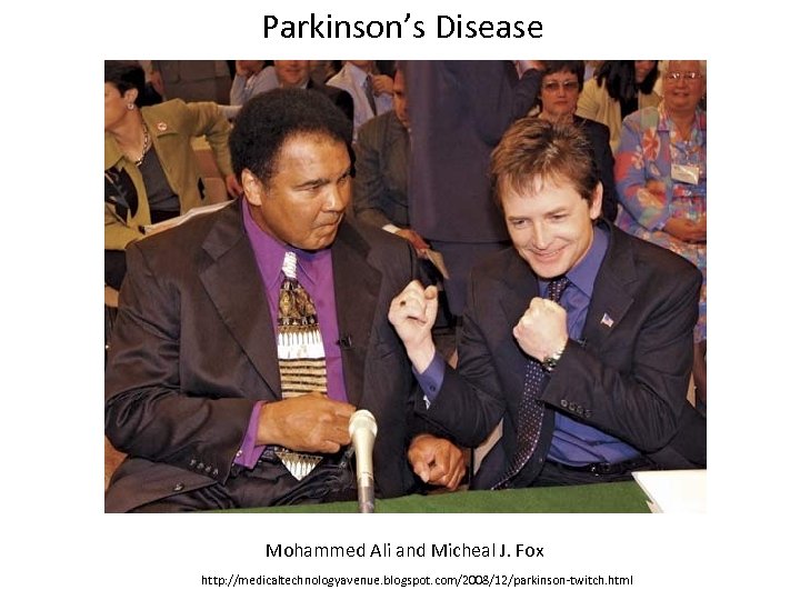 Parkinson’s Disease Mohammed Ali and Micheal J. Fox http: //medicaltechnologyavenue. blogspot. com/2008/12/parkinson-twitch. html 