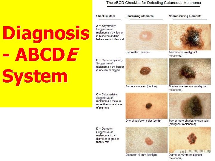 Diagnosis - ABCDE System 