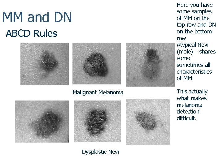 Here you have some samples of MM on the top row and DN on