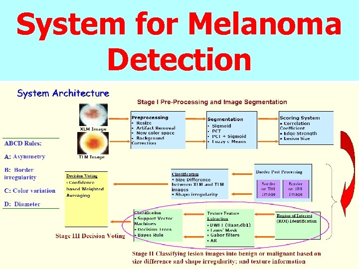 System for Melanoma Detection 
