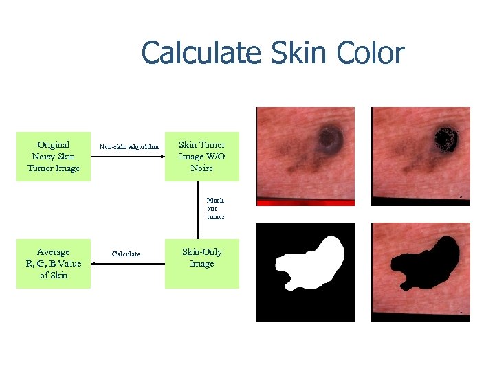 Calculate Skin Color Original Noisy Skin Tumor Image Non-skin Algorithm Skin Tumor Image W/O