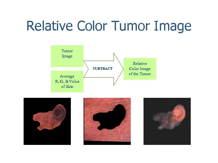 Relative Color Tumor Image SUBTRACT Average R, G, B Value of Skin Relative Color