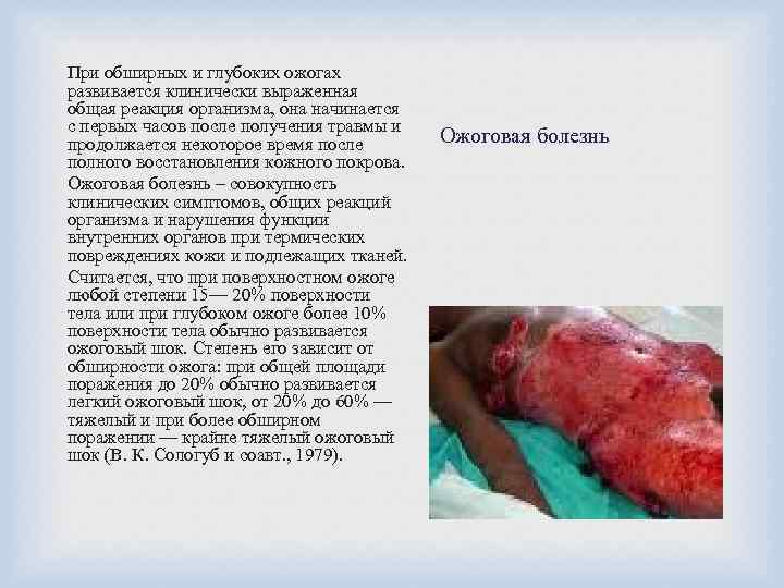 При обширных и глубоких ожогах развивается клинически выраженная общая реакция организма, она начинается с